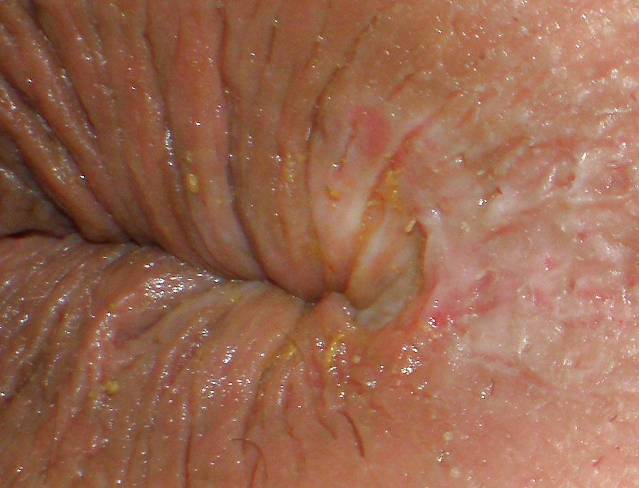 My girlie butthole as 18 y 3 m old porn pictures