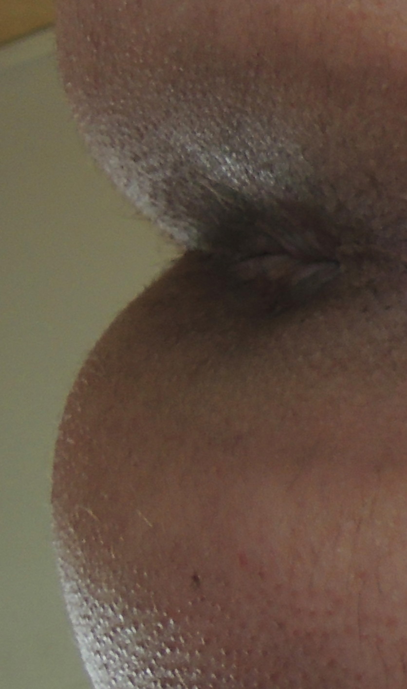 My butthole may 2013 porn pictures