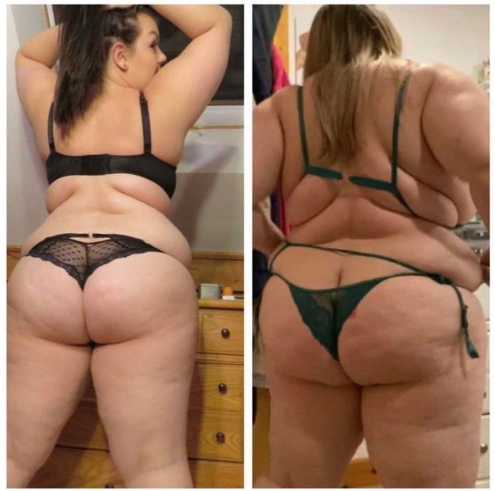 Weight Gain Before And After 6 - 30 Photos 