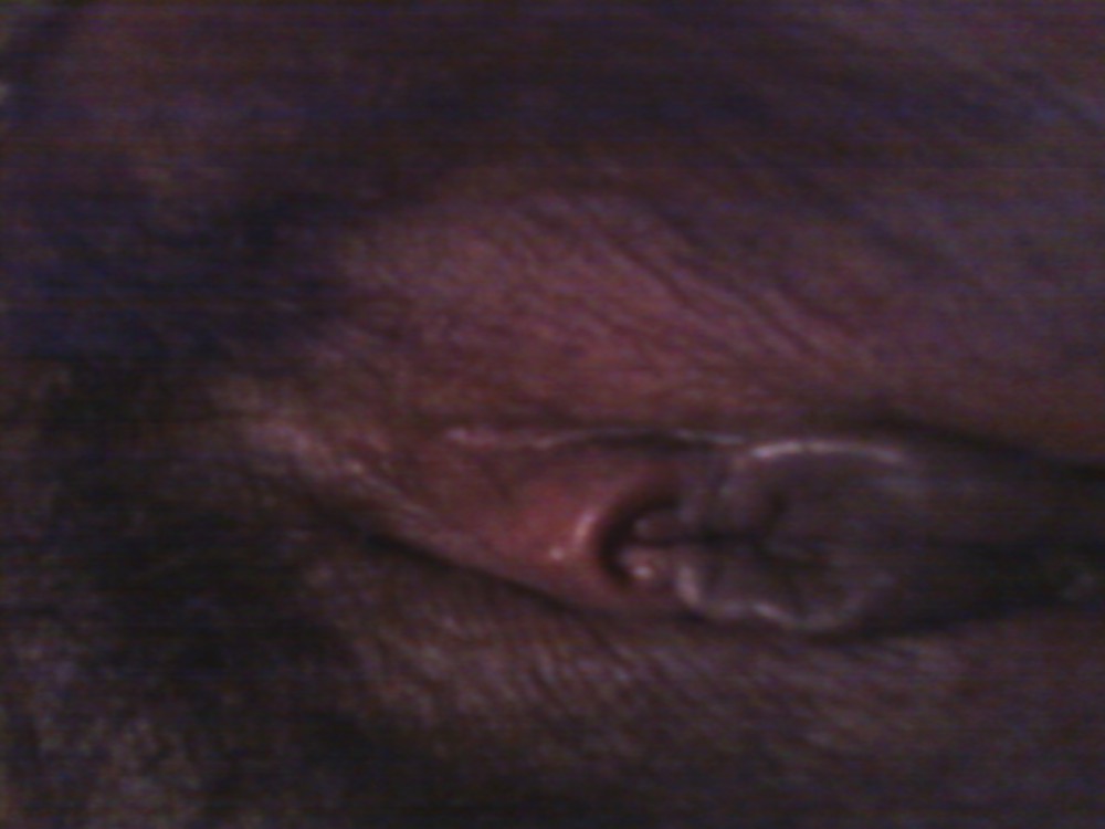 chuukese konak 2 porn pictures