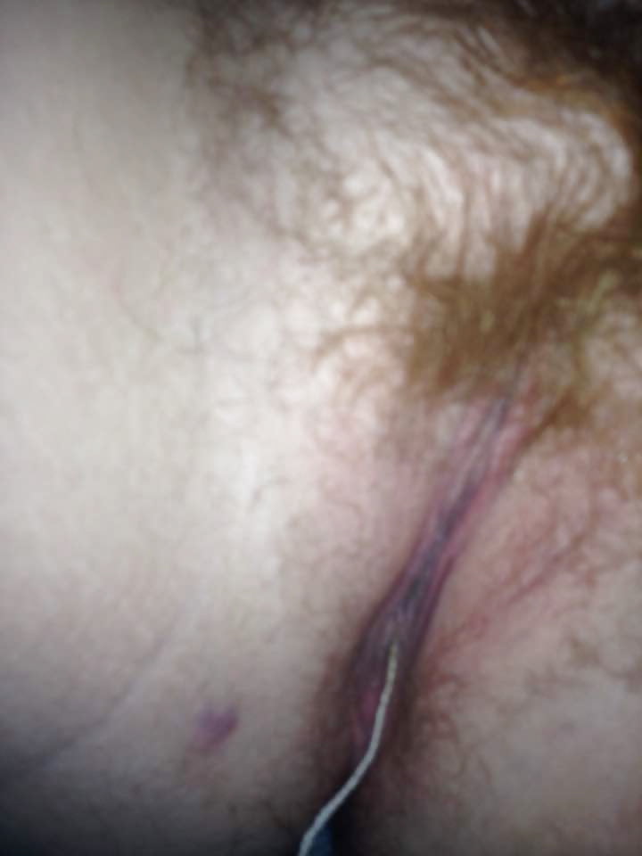 Ugly Ginger Pussy!! porn pictures