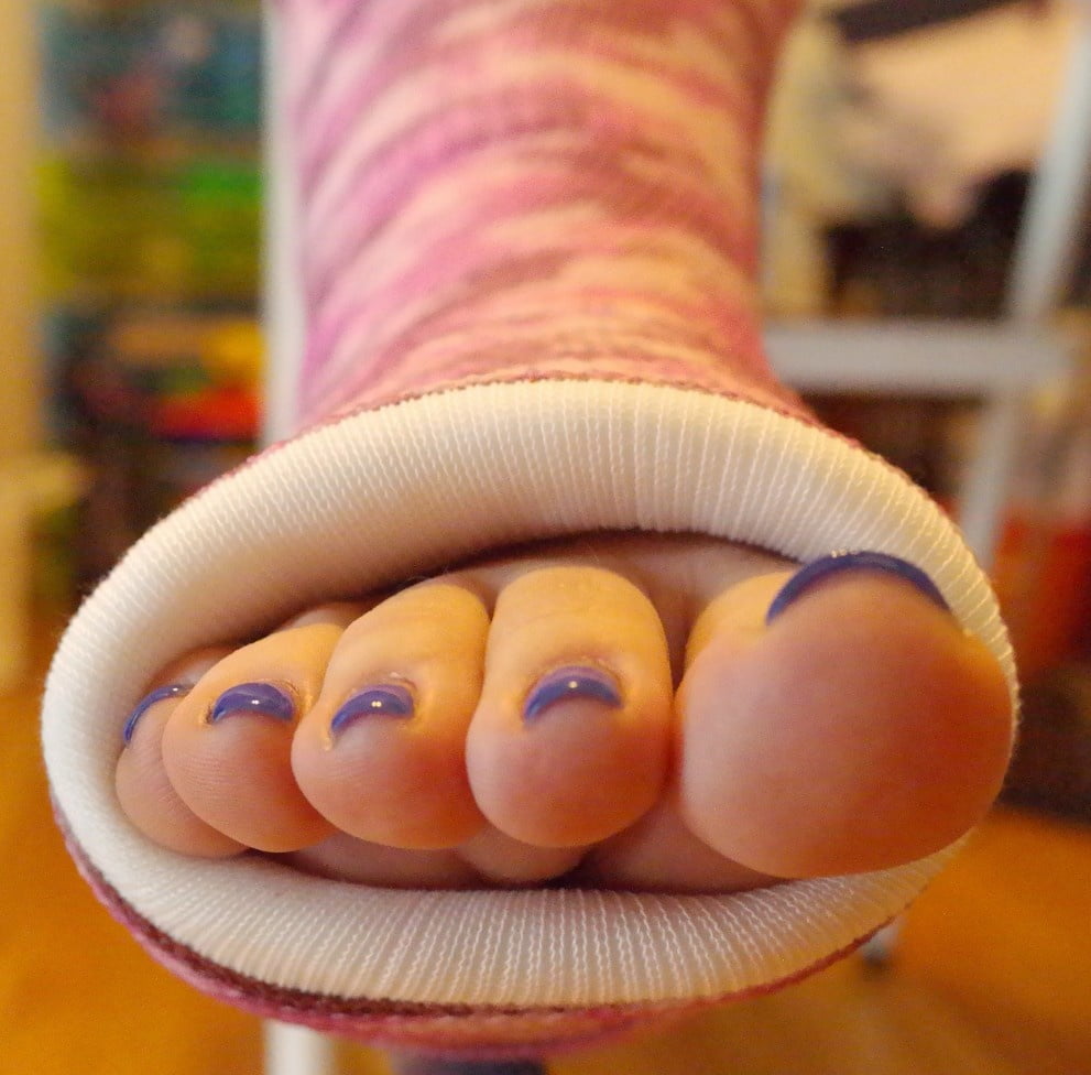 Toes in Casts (Webfinds) - 13 Photos 