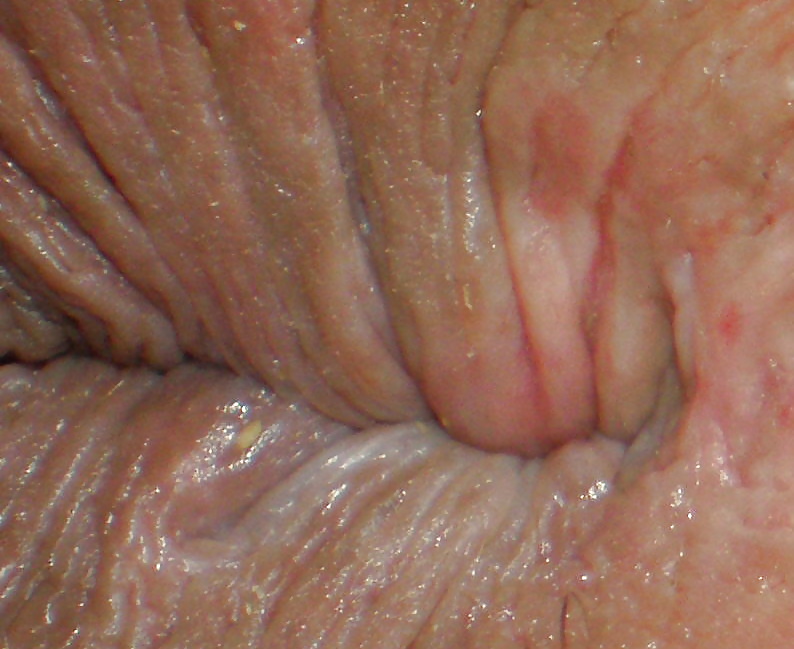 My 18 year old butthole (a few years ago) porn pictures
