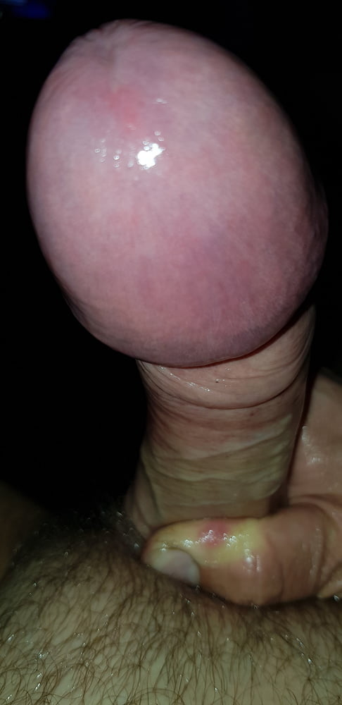 Mushroom Cock Head 63 Pics Xhamster