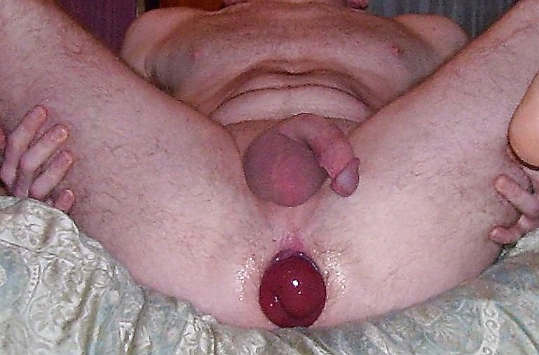 prolapse and ass gape porn pictures
