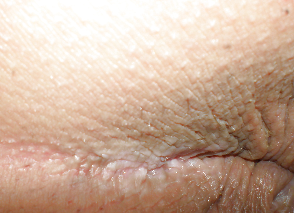 My butthole - pics boys made before or after anal sex porn pictures