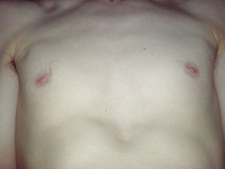 my body & nipples