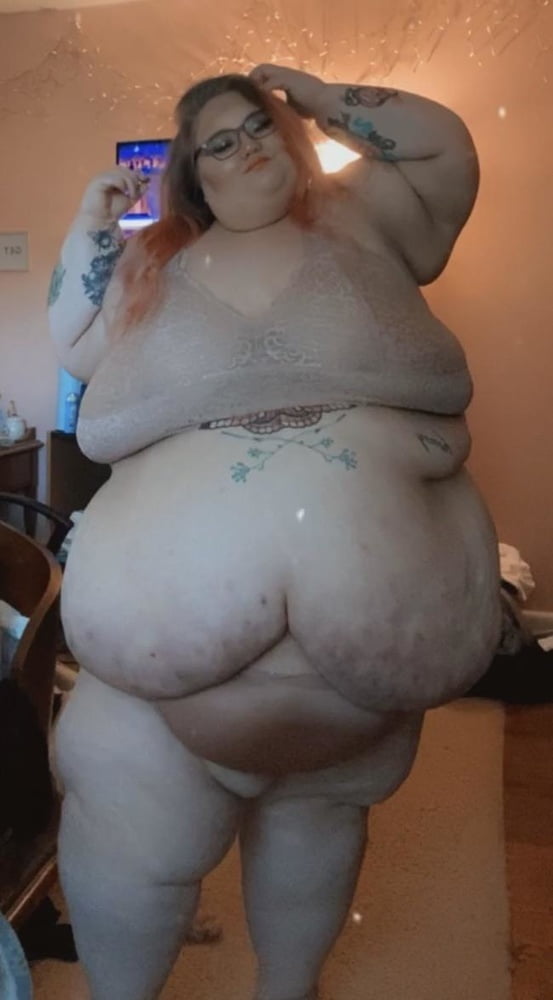 SSBBW REALITY - discolored skin, scars, bedsores, acne - 42 Photos 
