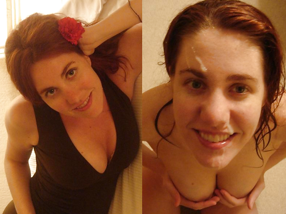 Before-After Facials porn pictures