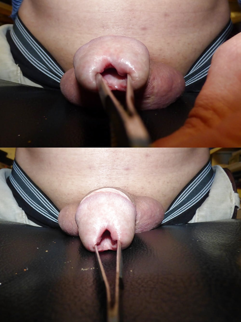 Extreme urethra insertions