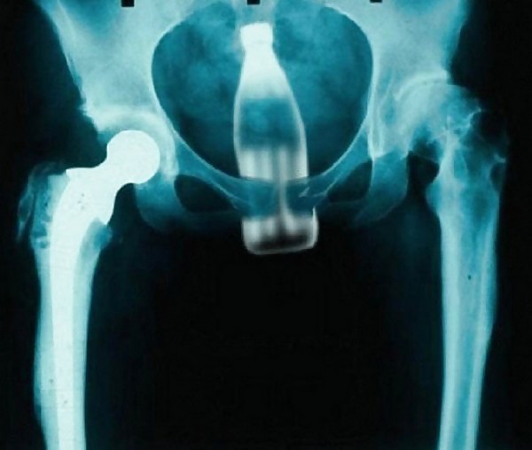 bad x-rays porn pictures