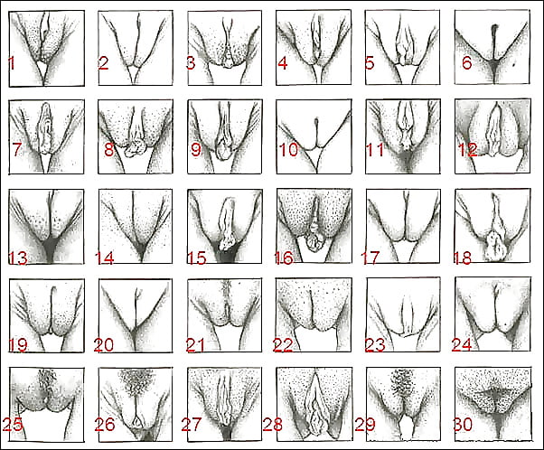 What are the types of pussy 15