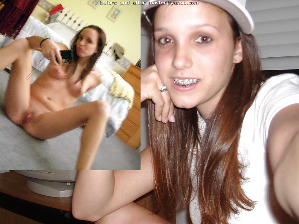 before and after pics - teens porn pictures