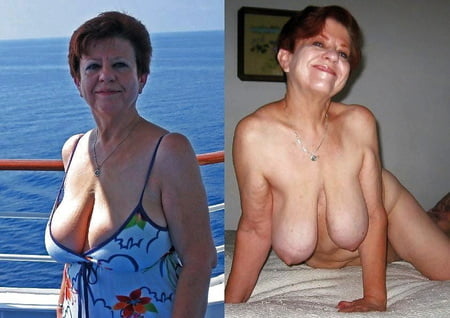 Before And After Gilf Porn - Before After Granny - 241 Pics | xHamster
