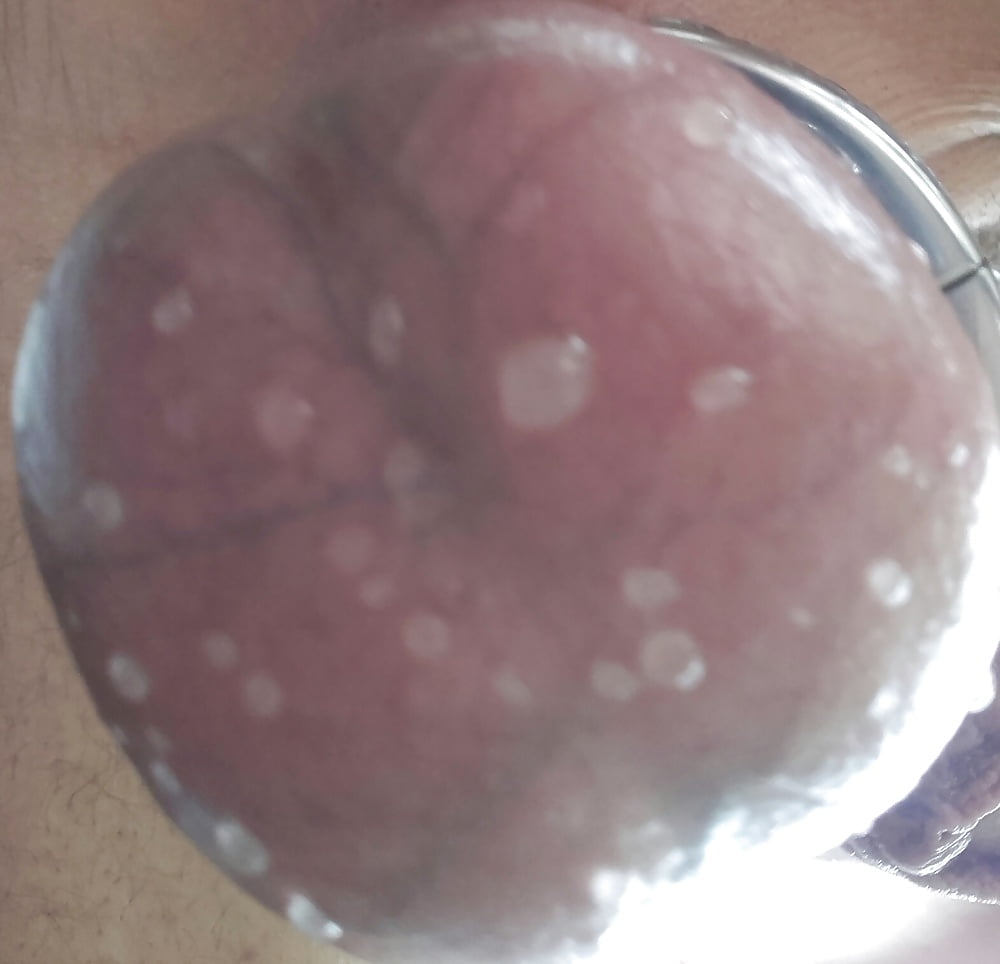 Balltorture and stretching porn pictures